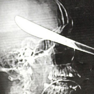 x-ray-article-752578358